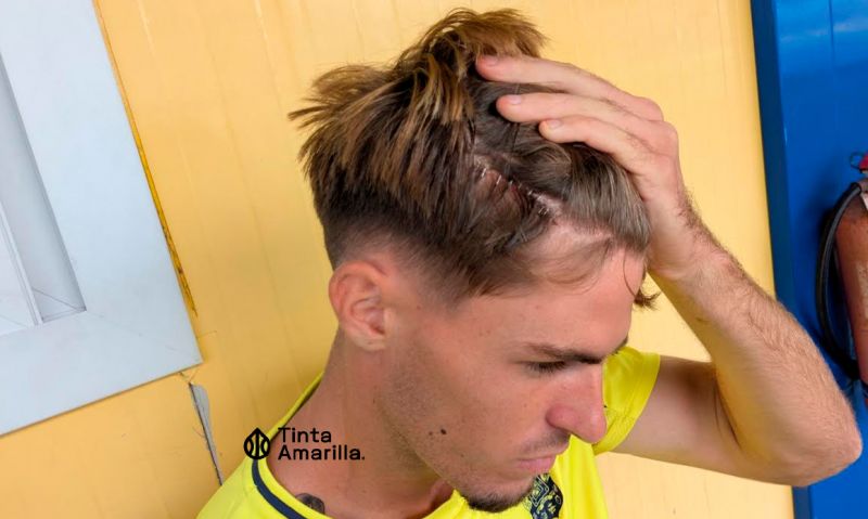 Aidan Pérez: 10 grapas de sutura tras su brecha en el derbi de filiales
