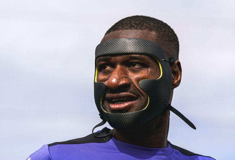 Sylla jugará ante la UD con una protección tras fractura de mandíbula