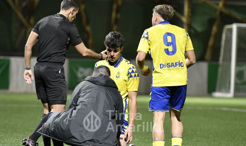 6 puntos y el golaverage: La brecha a favor de Las Palmas Atlético